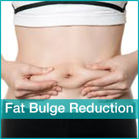 Fat Bulge Reduction